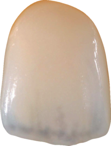 Courtesy of Ivoclar Vivadent